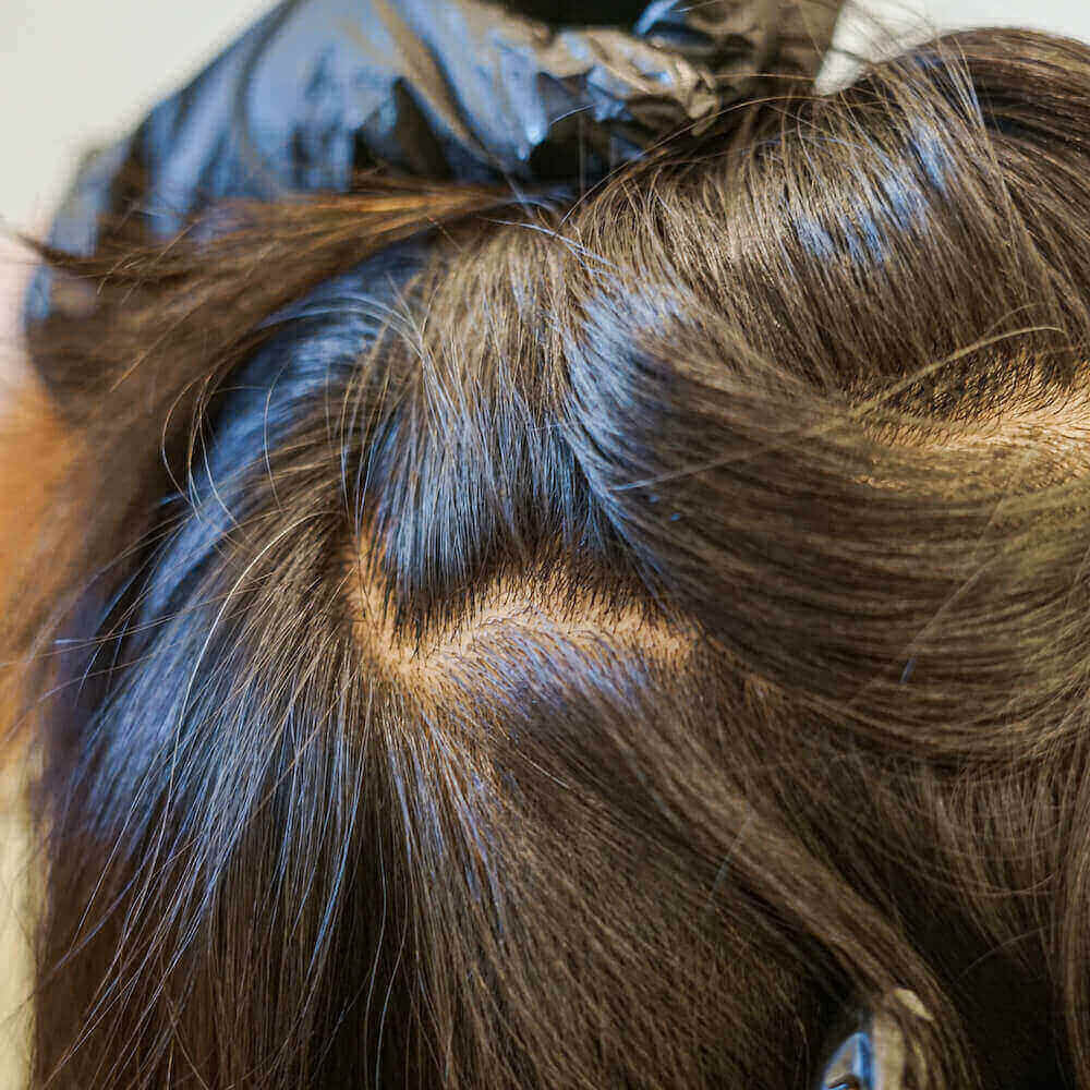 Healthy hair growth results following an Alopecia Treatment Bali ritual