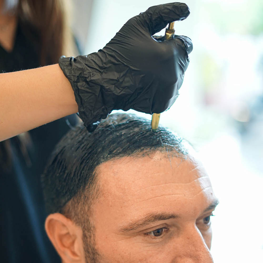 Supportive scalp therapy Alopecia recovery Canggu Bali